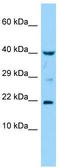 Interleukin-36 gamma antibody, TA333744, Origene, Western Blot image 
