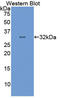Ubiquitin Protein Ligase E3A antibody, LS-C296911, Lifespan Biosciences, Western Blot image 