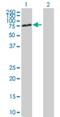 Debranching RNA Lariats 1 antibody, H00051163-B01P, Novus Biologicals, Western Blot image 