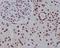 Histone Cluster 1 H2A Family Member E antibody, M16777, Boster Biological Technology, Immunohistochemistry frozen image 