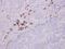 Immunoglobulin Lambda Like Polypeptide 1 antibody, PA5-29712, Invitrogen Antibodies, Immunohistochemistry paraffin image 