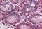 Polymeric Immunoglobulin Receptor antibody, orb96734, Biorbyt, Immunohistochemistry paraffin image 