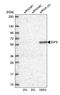 Eukaryotic Translation Initiation Factor 5 antibody, PA5-51472, Invitrogen Antibodies, Western Blot image 