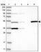 Tetratricopeptide Repeat Domain 38 antibody, PA5-56108, Invitrogen Antibodies, Western Blot image 