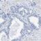 Glial Cells Missing Transcription Factor 1 antibody, PA5-52819, Invitrogen Antibodies, Immunohistochemistry frozen image 