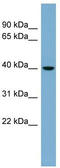 VPS37C Subunit Of ESCRT-I antibody, TA344946, Origene, Western Blot image 