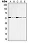 Keratin 10 antibody, MBS821751, MyBioSource, Western Blot image 