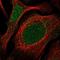 Coiled-Coil Domain Containing 92 antibody, NBP1-82119, Novus Biologicals, Immunofluorescence image 