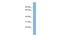 E3 ubiquitin-protein ligase TRAF7 antibody, A05972, Boster Biological Technology, Western Blot image 