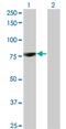 Protein Kinase C Delta antibody, MA5-19701, Invitrogen Antibodies, Western Blot image 