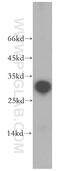 Nuclear Receptor Interacting Protein 2 antibody, 17704-1-AP, Proteintech Group, Western Blot image 
