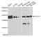 Phospholipase C Gamma 1 antibody, A7711, ABclonal Technology, Western Blot image 