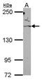 Rho Associated Coiled-Coil Containing Protein Kinase 2 antibody, GTX108247, GeneTex, Western Blot image 