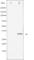 CCAAT Enhancer Binding Protein Beta antibody, abx011893, Abbexa, Western Blot image 