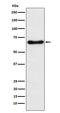 Cytochrome P450 Family 24 Subfamily A Member 1 antibody, M00343, Boster Biological Technology, Western Blot image 