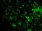 Patched 1 antibody, orb16261, Biorbyt, Immunohistochemistry paraffin image 