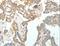 Actinin Alpha 1 antibody, LS-C404496, Lifespan Biosciences, Immunohistochemistry paraffin image 