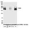 CD45 antibody, A700-012, Bethyl Labs, Western Blot image 