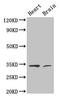 Cyclin Dependent Kinase 5 antibody, CSB-PA005067LA01HU, Cusabio, Western Blot image 