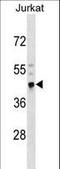 Cysteine Rich With EGF Like Domains 2 antibody, LS-C159405, Lifespan Biosciences, Western Blot image 