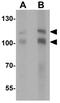 E3 ubiquitin-protein ligase BRE1A antibody, GTX31540, GeneTex, Western Blot image 