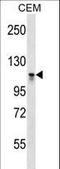 DNA Methyltransferase 3 Alpha antibody, LS-C167492, Lifespan Biosciences, Western Blot image 