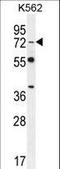 Dishevelled Segment Polarity Protein 3 antibody, LS-C167587, Lifespan Biosciences, Western Blot image 