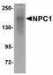 Nasopharyngeal carinmoma  antibody, LS-B6977, Lifespan Biosciences, Western Blot image 