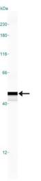 Prostaglandin D2 Synthase antibody, NB110-59909, Novus Biologicals, Western Blot image 