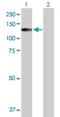 Transient Receptor Potential Cation Channel Subfamily A Member 1 antibody, H00008989-D01P, Novus Biologicals, Western Blot image 