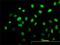 Aryl Hydrocarbon Receptor antibody, H00000196-M02, Novus Biologicals, Immunocytochemistry image 
