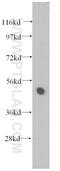 Tetratricopeptide Repeat Domain 4 antibody, 11878-1-AP, Proteintech Group, Western Blot image 