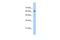 Zinc Finger Protein 675 antibody, A06418, Boster Biological Technology, Western Blot image 