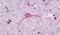 Neurotensin Receptor 1 antibody, PA5-34027, Invitrogen Antibodies, Immunohistochemistry frozen image 