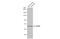 Glutamate Decarboxylase 2 antibody, GTX113192, GeneTex, Western Blot image 