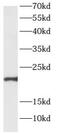 ADP Ribosylation Factor Like GTPase 2 Binding Protein antibody, FNab00575, FineTest, Western Blot image 