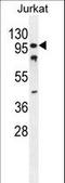 CWC22 Spliceosome Associated Protein Homolog antibody, LS-C167165, Lifespan Biosciences, Western Blot image 