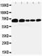 Paxillin antibody, MA1080, Boster Biological Technology, Western Blot image 