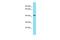 SDS3 Homolog, SIN3A Corepressor Complex Component antibody, PA5-70549, Invitrogen Antibodies, Western Blot image 