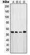Phosphatase And Tensin Homolog antibody, LS-C352741, Lifespan Biosciences, Western Blot image 