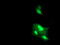 Dystrobrevin beta antibody, LS-C173762, Lifespan Biosciences, Immunofluorescence image 