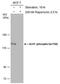 Unc-51 Like Autophagy Activating Kinase 1 antibody, PA5-78251, Invitrogen Antibodies, Western Blot image 