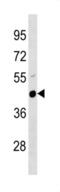 Plasminogen Activator, Urokinase antibody, abx034650, Abbexa, Western Blot image 