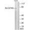 Solute Carrier Family 27 Member 5 antibody, A09287, Boster Biological Technology, Western Blot image 