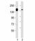 Lysine Demethylase 6A antibody, F53253-0.4ML, NSJ Bioreagents, Western Blot image 