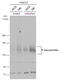 ATP Binding Cassette Subfamily B Member 1 antibody, GTX108354, GeneTex, Western Blot image 