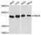 Phosphomevalonate Kinase antibody, LS-C748886, Lifespan Biosciences, Western Blot image 