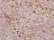 Protein Phosphatase 1 Regulatory Inhibitor Subunit 14A antibody, A05752T38, Boster Biological Technology, Immunohistochemistry frozen image 