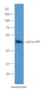 Ectonucleoside Triphosphate Diphosphohydrolase 7 antibody, orb10039, Biorbyt, Western Blot image 