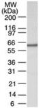 Coactivator Associated Arginine Methyltransferase 1 antibody, GTX13707, GeneTex, Western Blot image 
